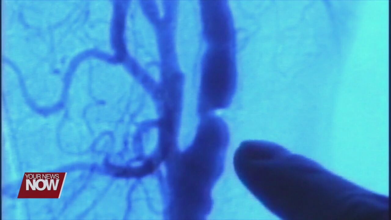 Senate Bill 21 mandates protocol for EMS dealing with stroke patients